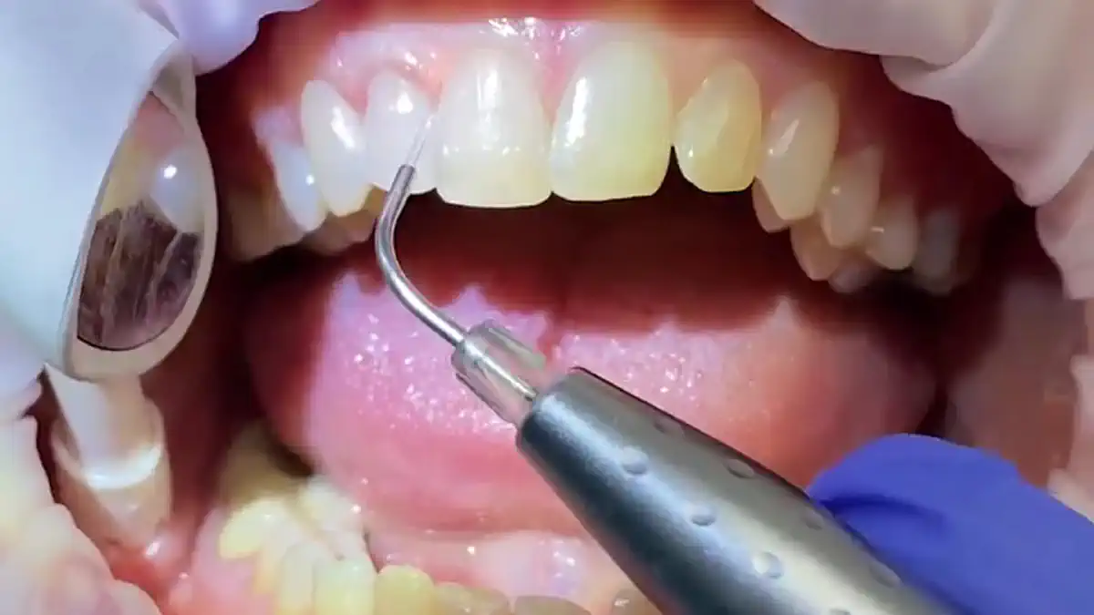 Vimeo video 507232145