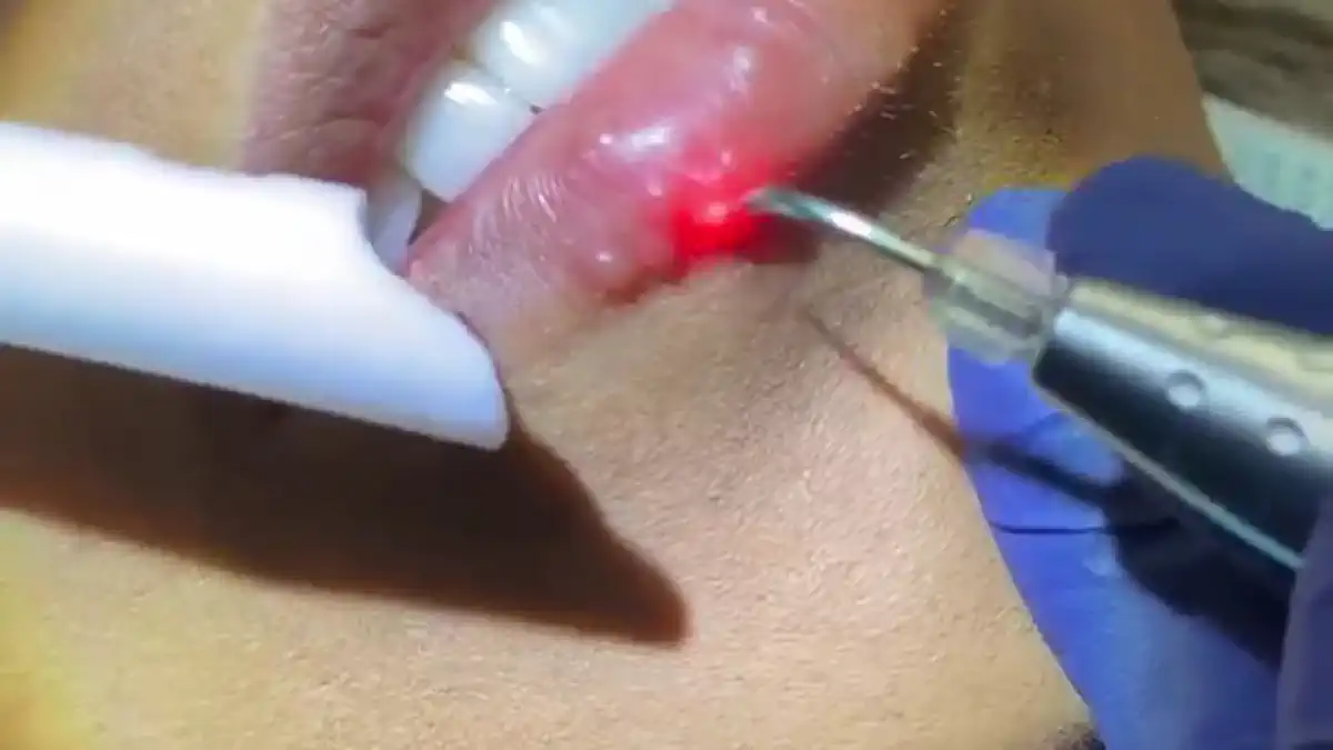 Vimeo video 507237831