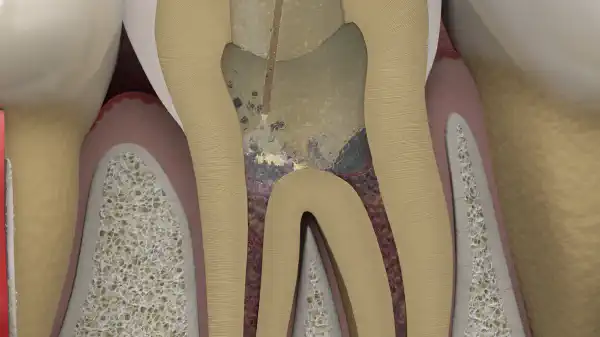 Vimeo video 574665932