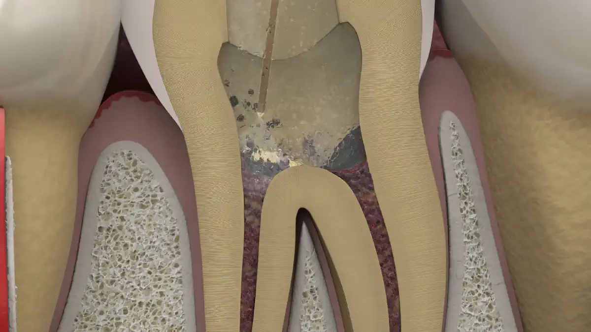 Vimeo video 574665932