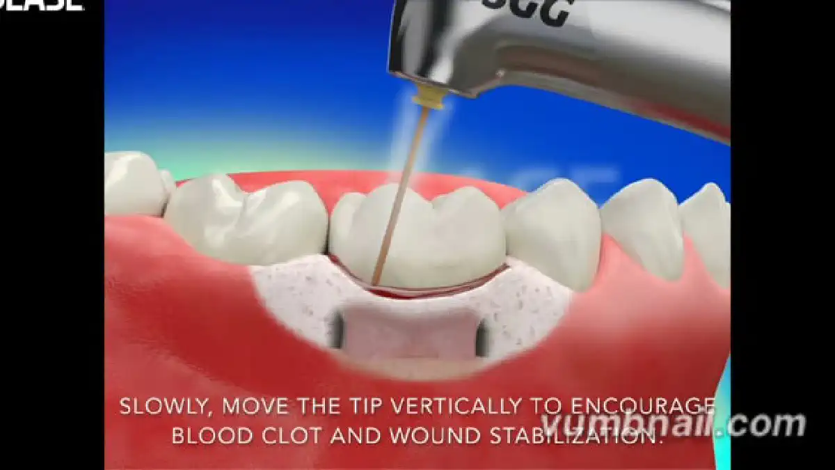 Vimeo video 207019413