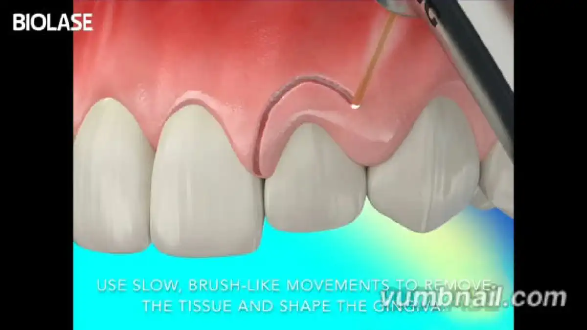 Vimeo video 207024648