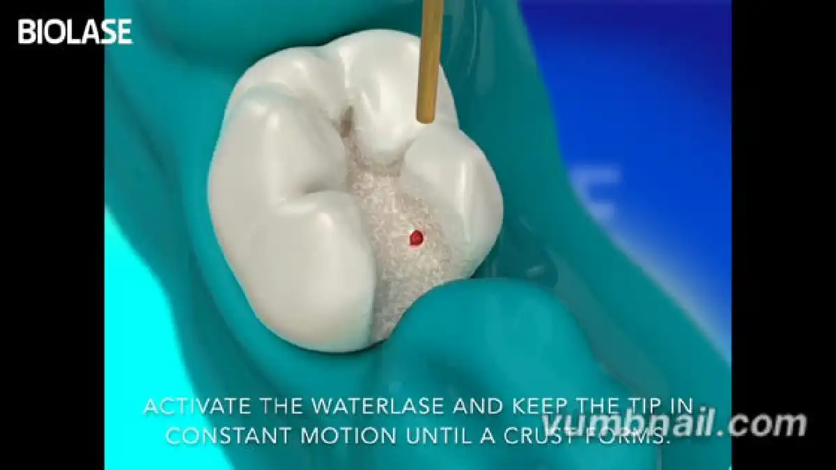 Vimeo video 207028256