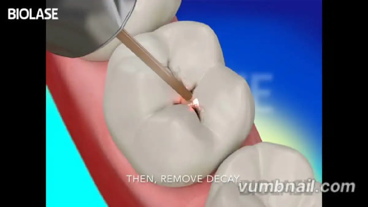 Vimeo video 207114442