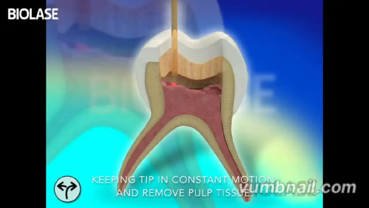 Vimeo video 207114576