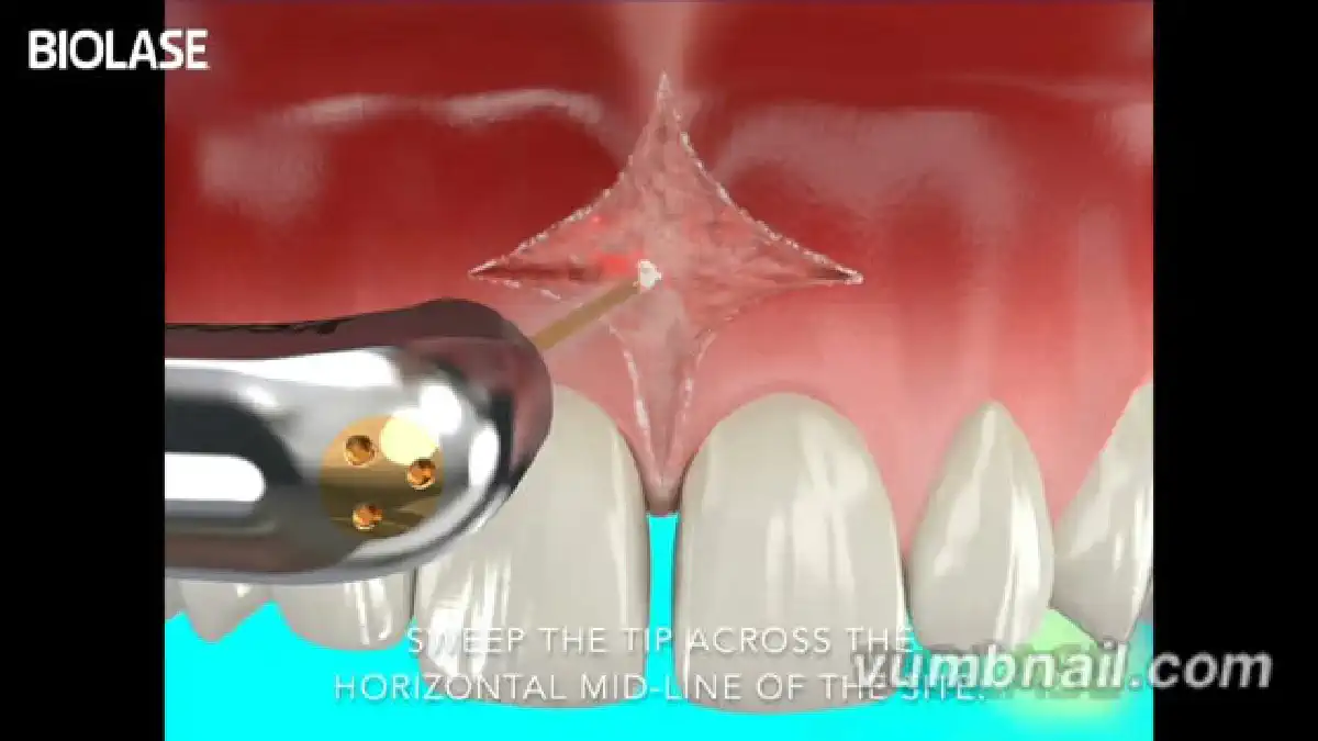 Vimeo video 207114676