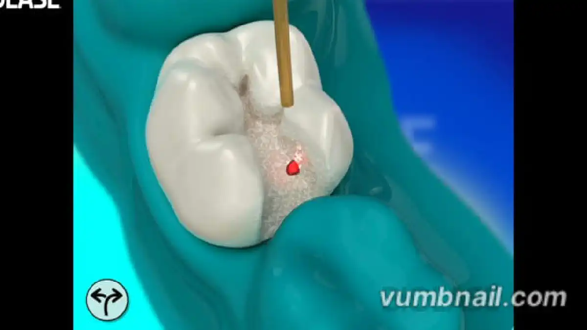 Vimeo video 207117860