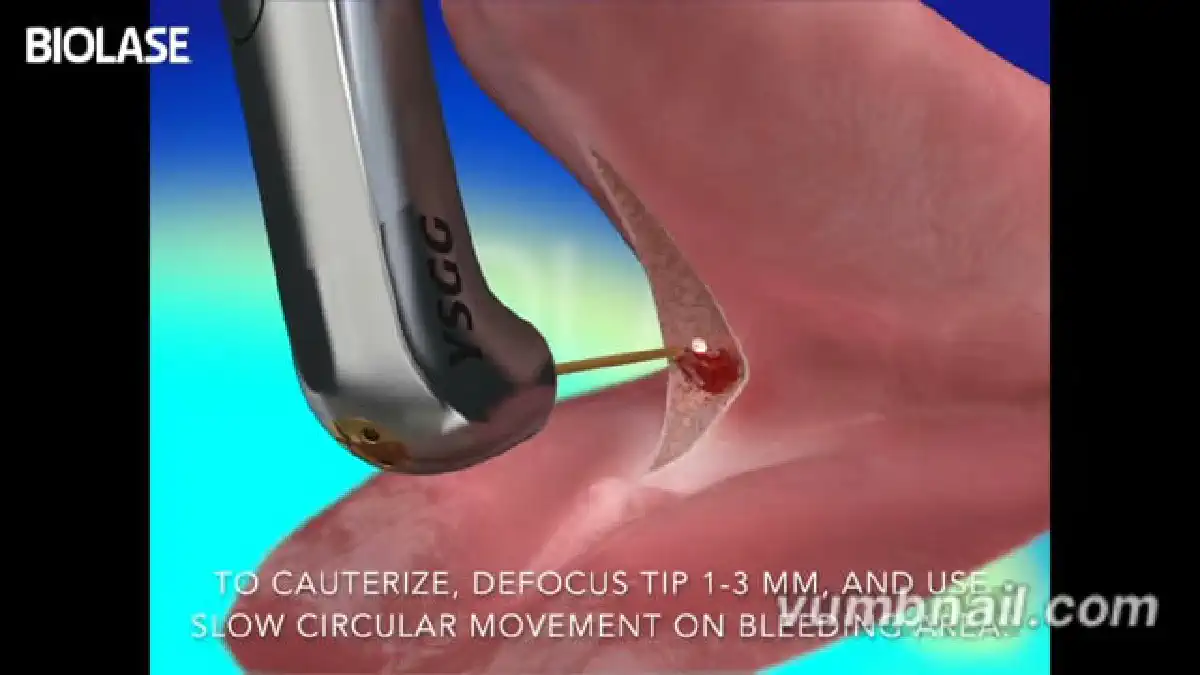 Vimeo video 207118380