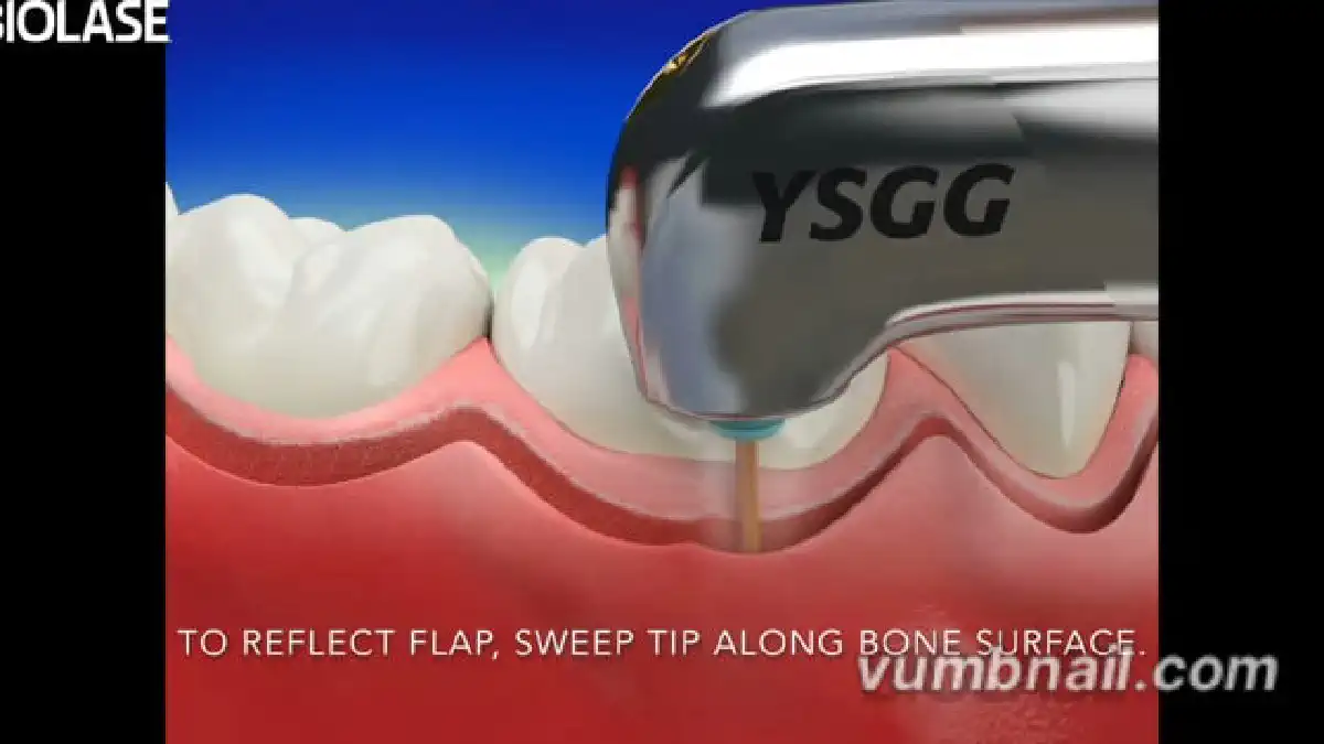 Vimeo video 207120570