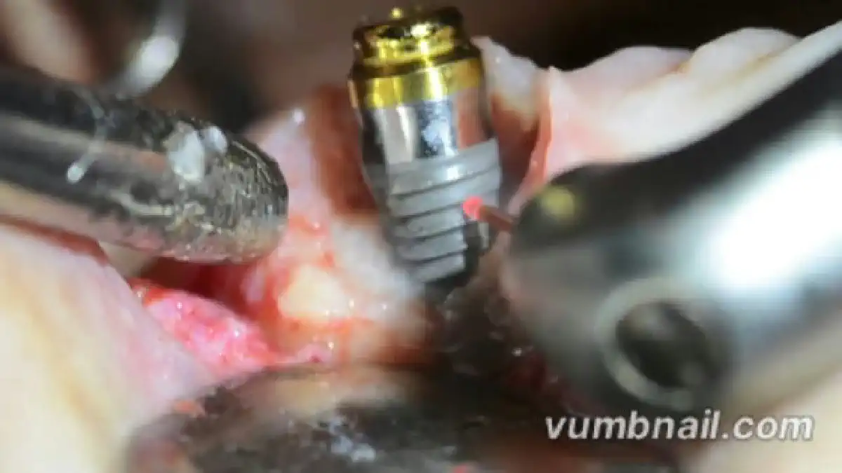 Vimeo video 310874740