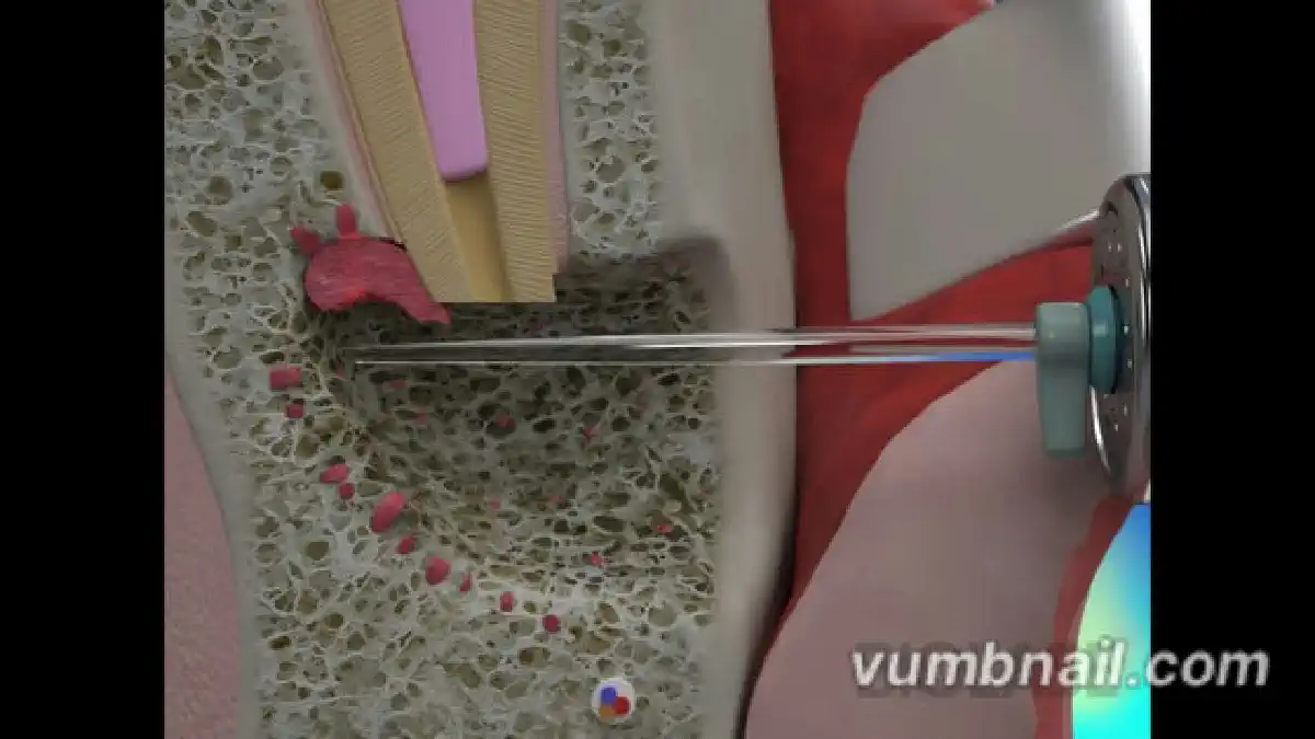 Vimeo video 387007463