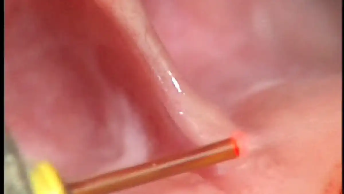 Vimeo video 82582707