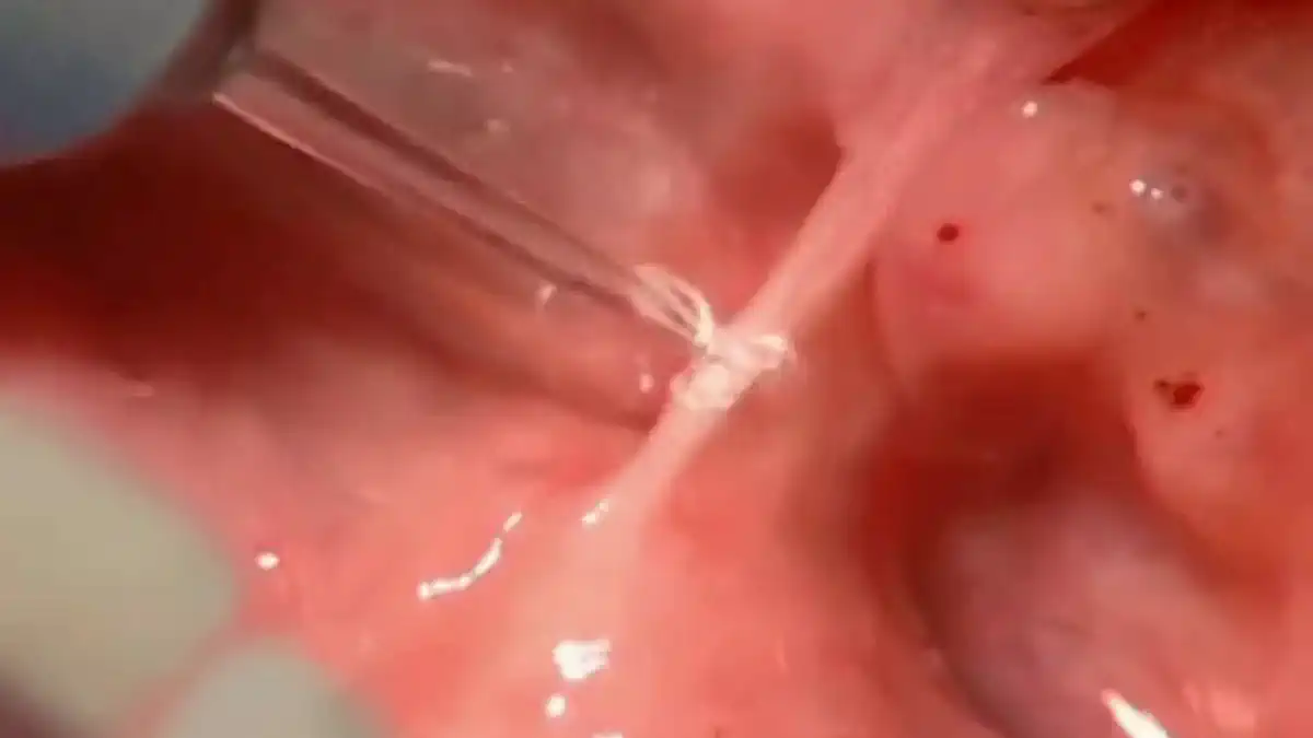 Vimeo video 82583146