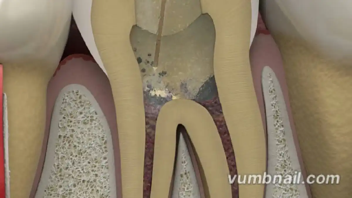 Vimeo video 574665932