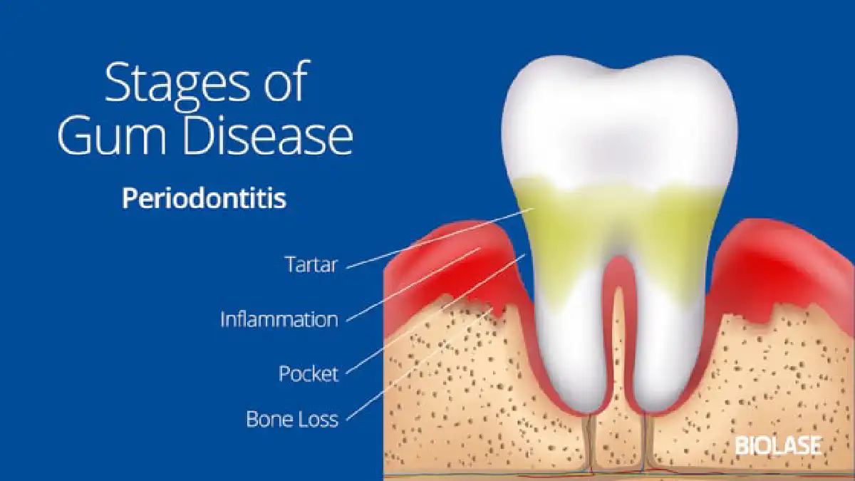 Vimeo video 202265487