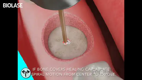 Vimeo video 207007867