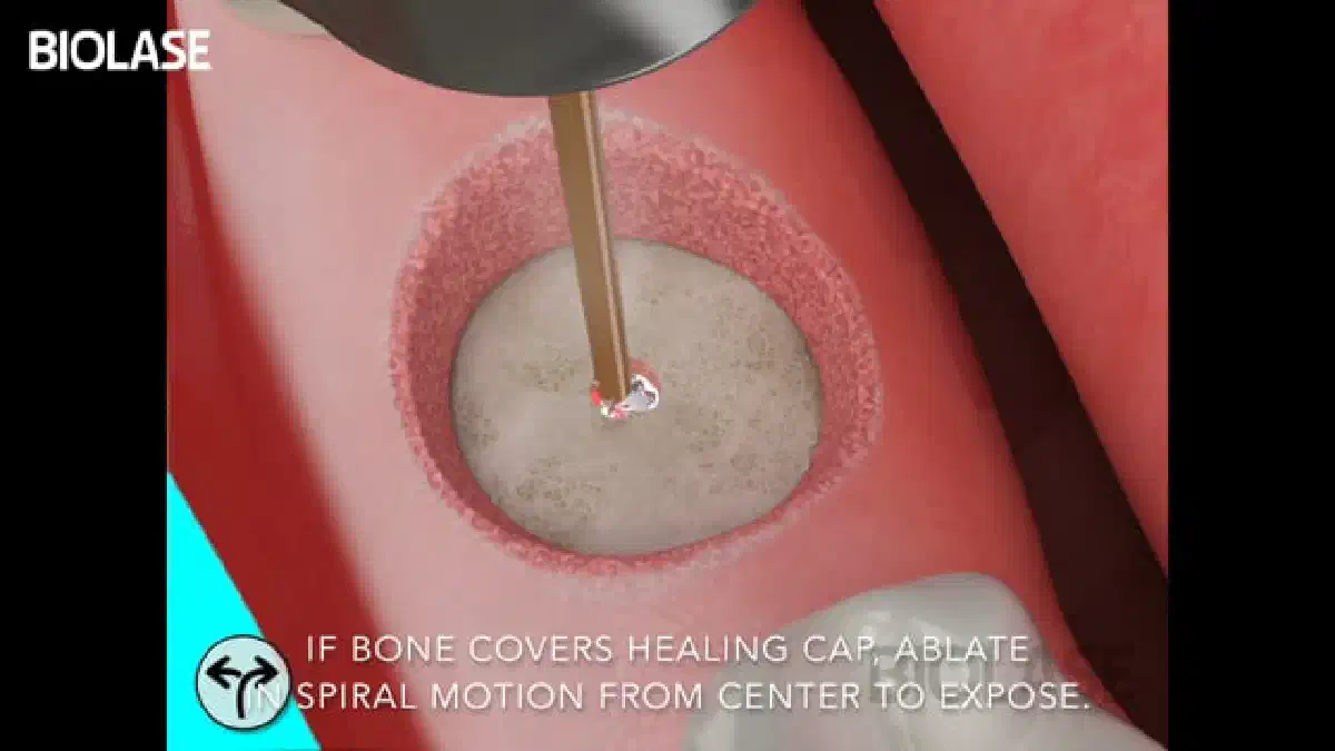 Vimeo video 207007867