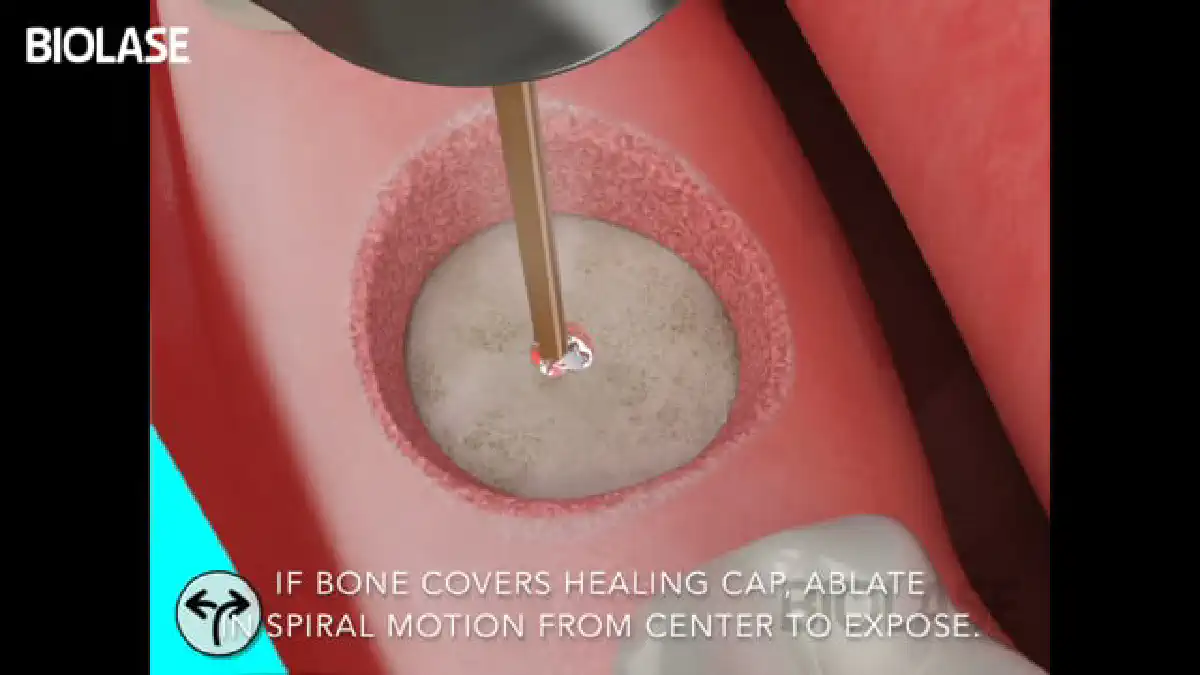 Vimeo video 207007867