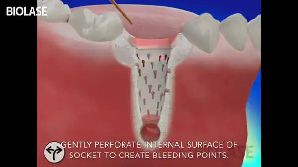 Vimeo video 207008786