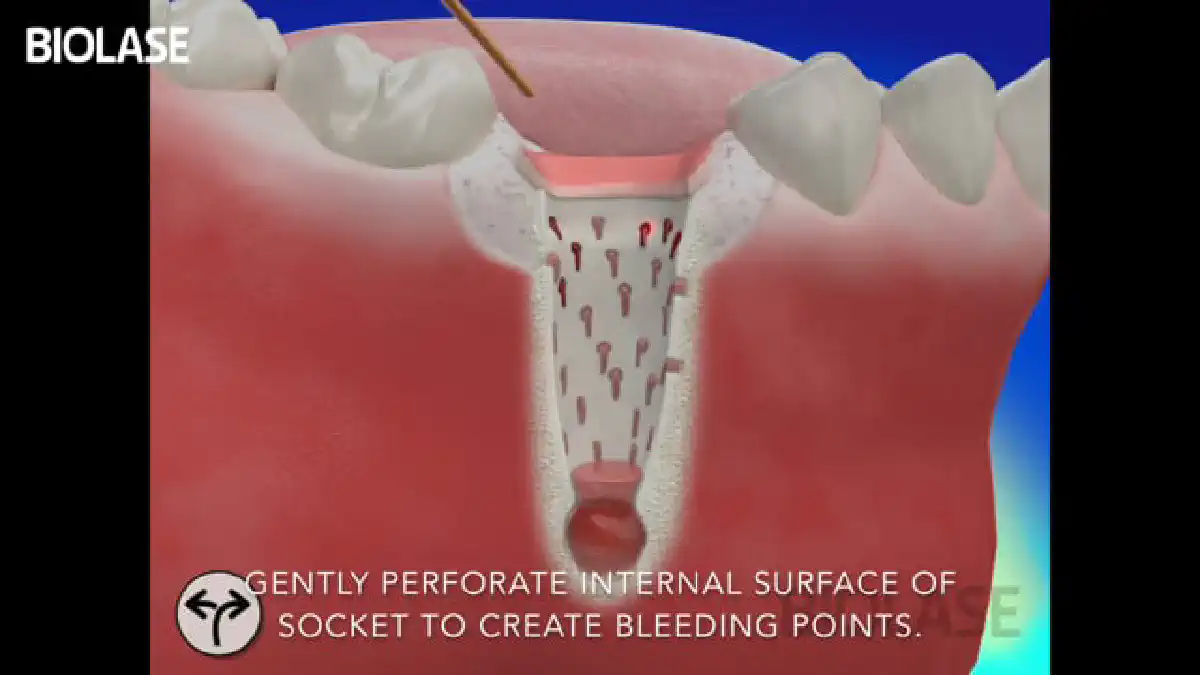 Vimeo video 207008786