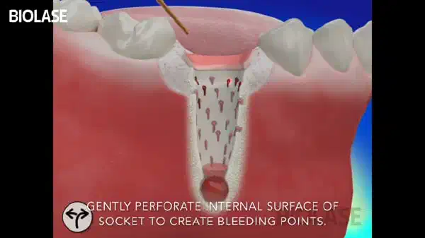Vimeo video 207008786