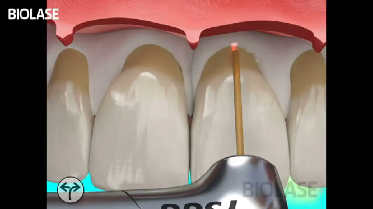 Vimeo video 207015238