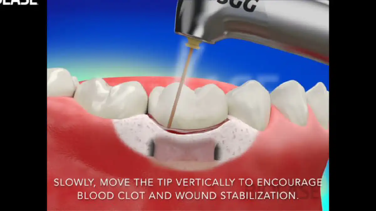 Vimeo video 207019413