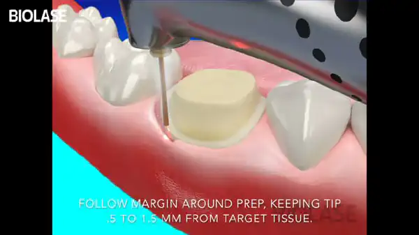 Vimeo video 207025901