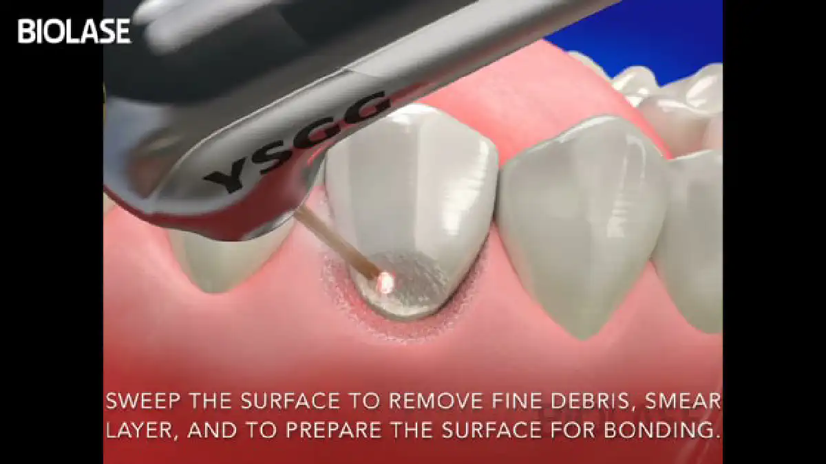 Vimeo video 207028040