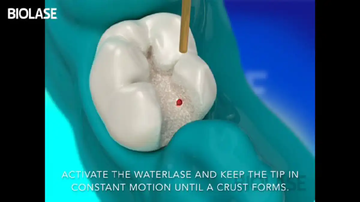 Vimeo video 207028256