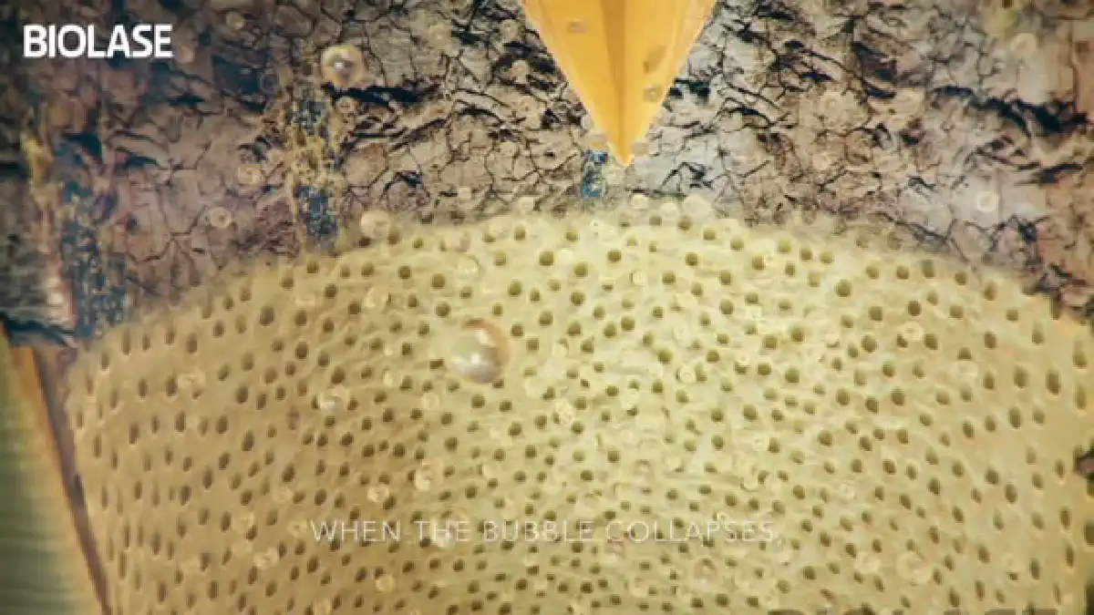 Vimeo video 207030705