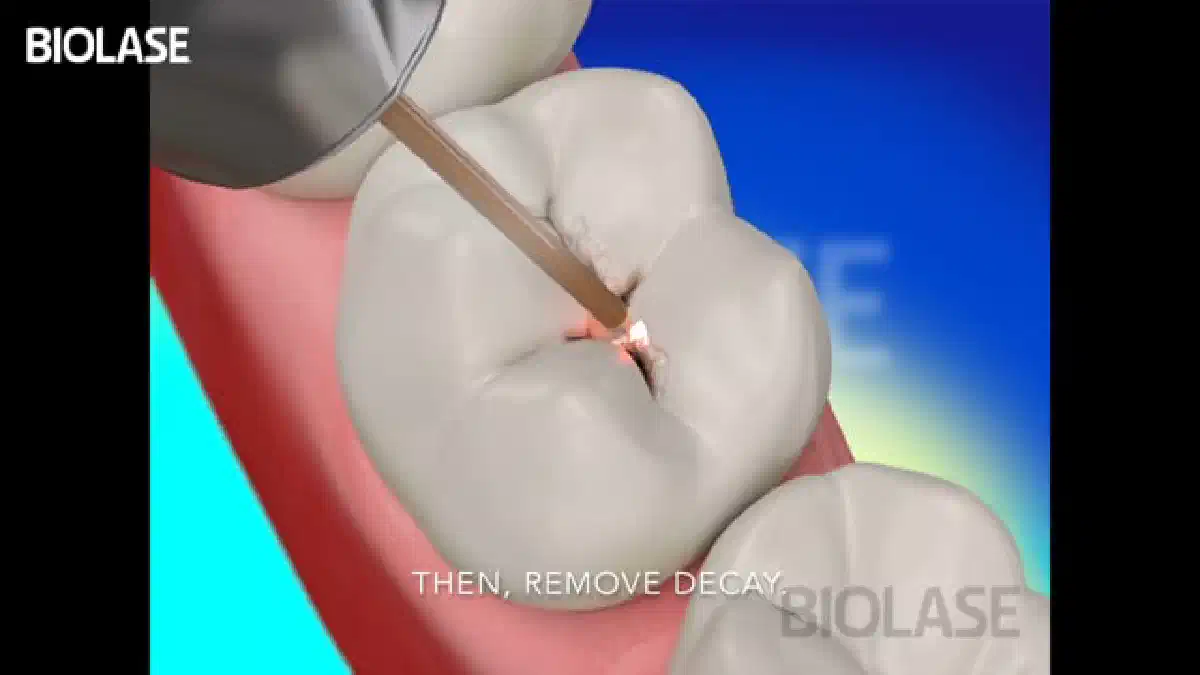 Vimeo video 207114442