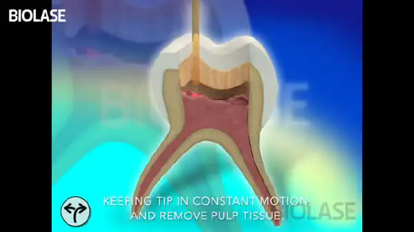 Vimeo video 207114576