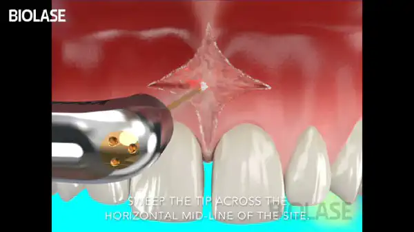 Vimeo video 207114676