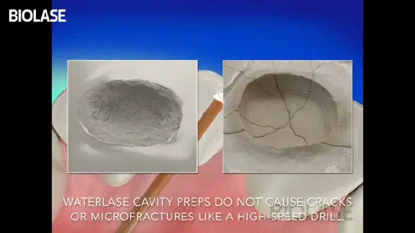 Vimeo video 207117760