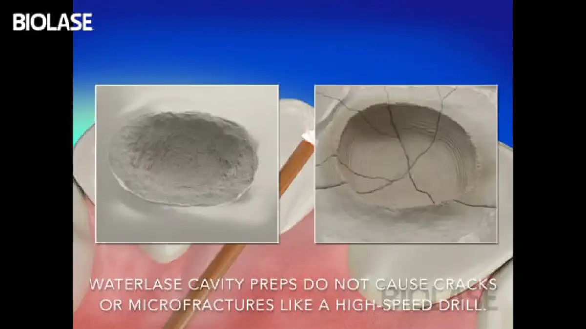 Vimeo video 207117760