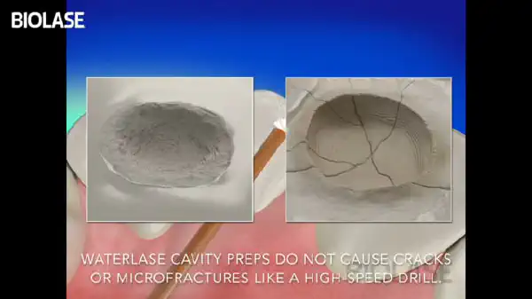 Vimeo video 207117760