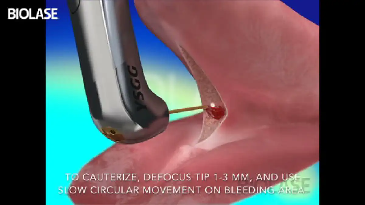 Vimeo video 207118380