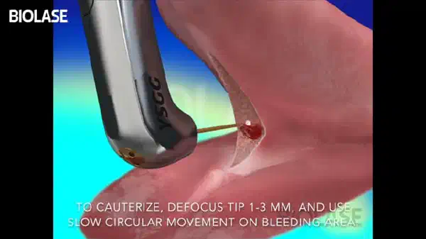 Vimeo video 207118380