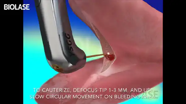 Vimeo video 207118380