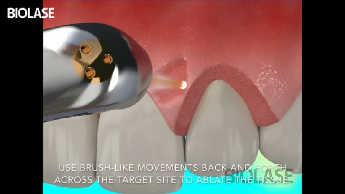 Vimeo video 207118667