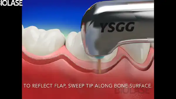 Vimeo video 207120570