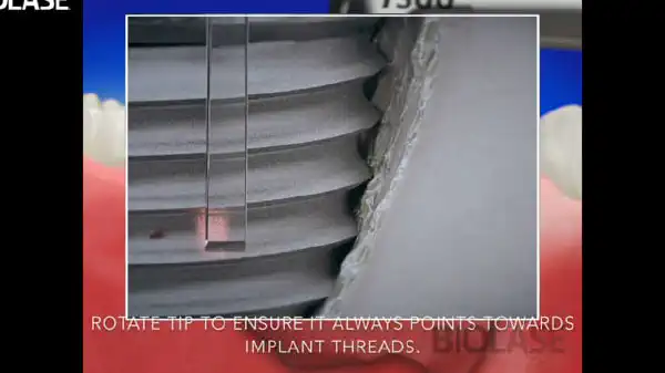 Vimeo video 207121458