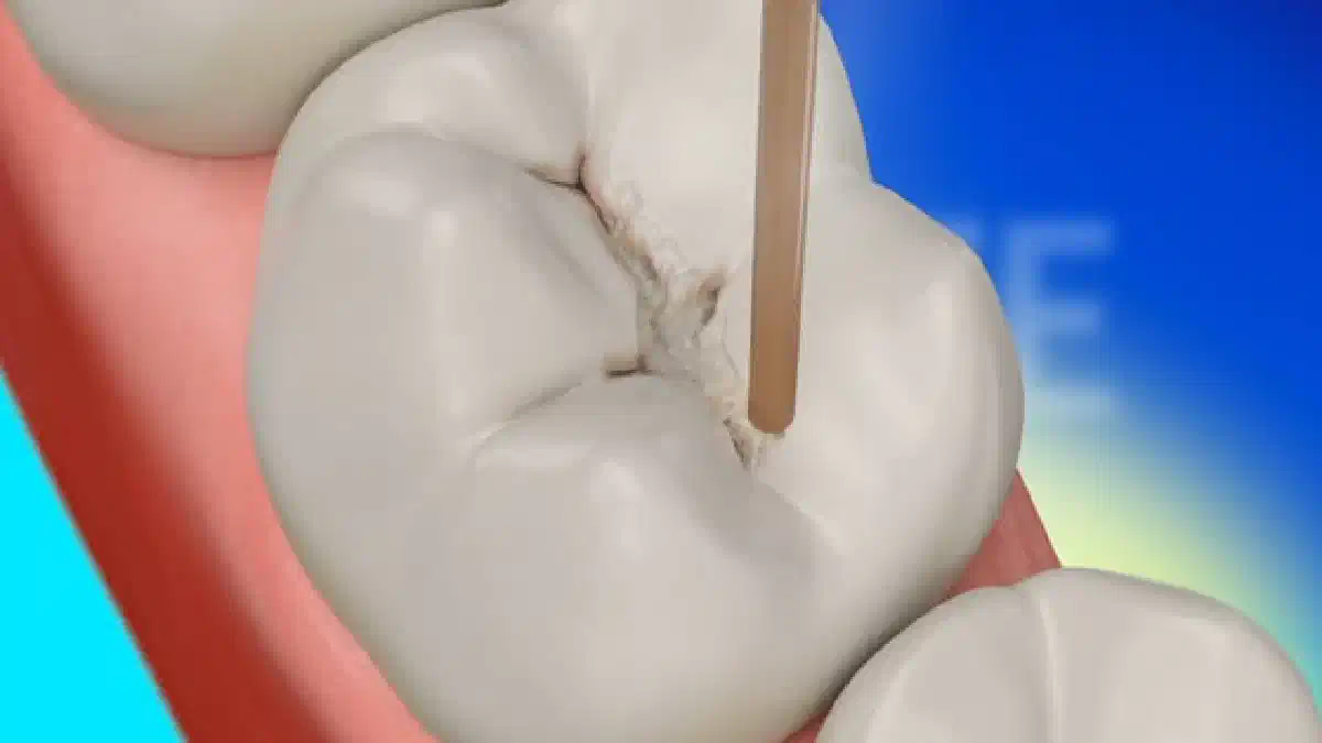 Vimeo video 206661729