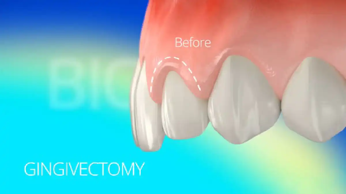 Vimeo video 212327171