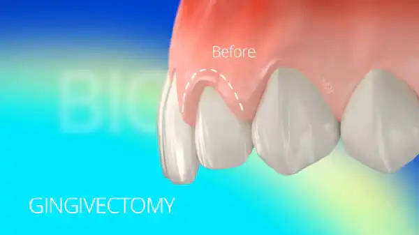 Vimeo video 212327171