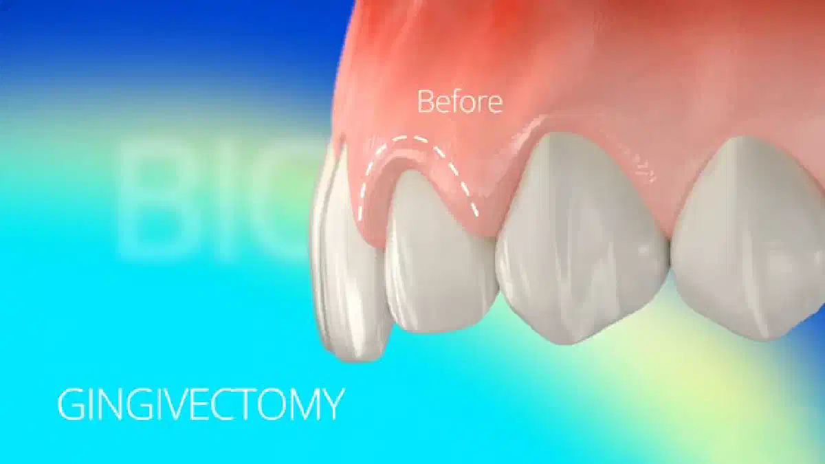 Vimeo video 212327171