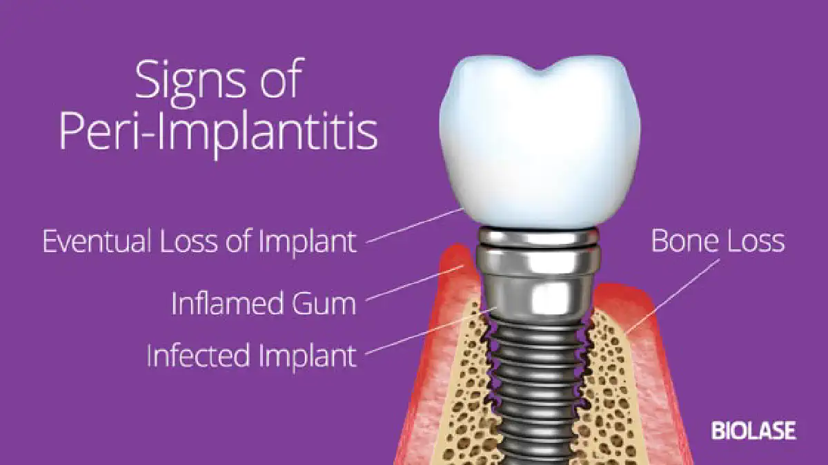 Vimeo video 212331922