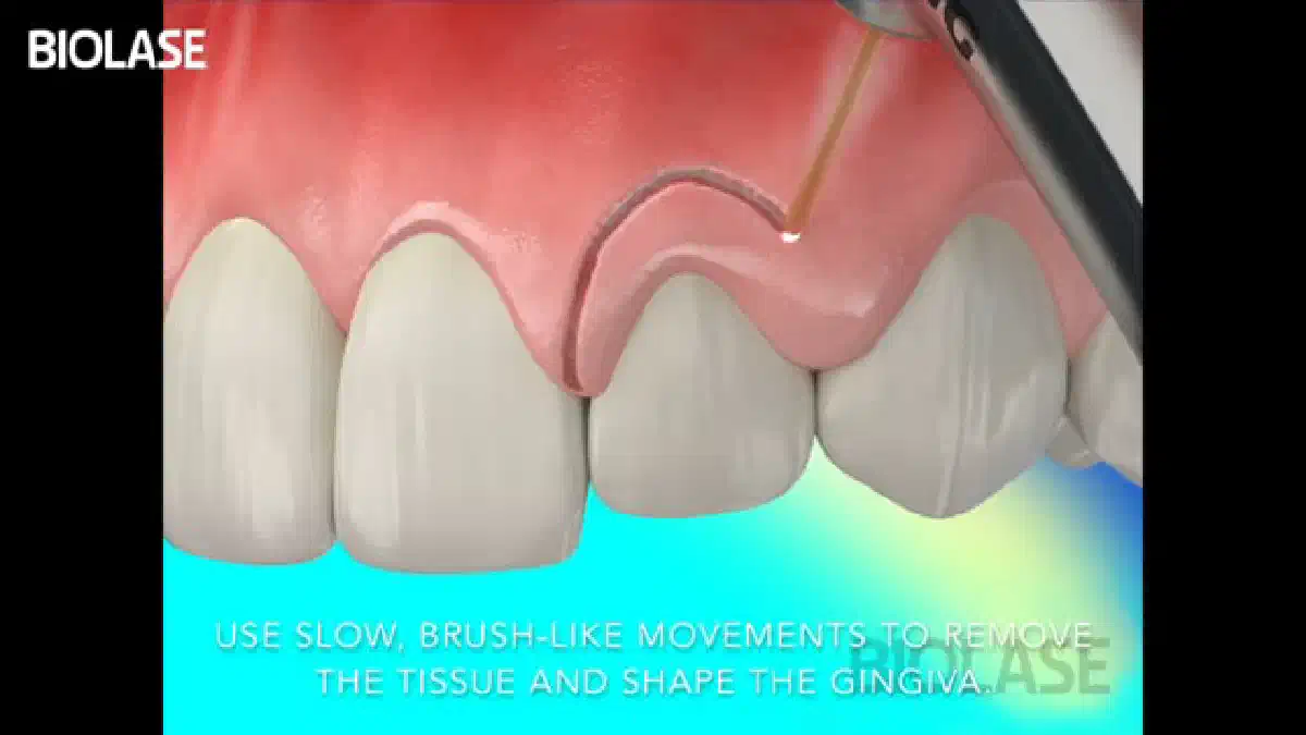Vimeo video 207024648