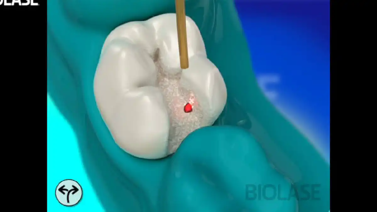 Vimeo video 207117860